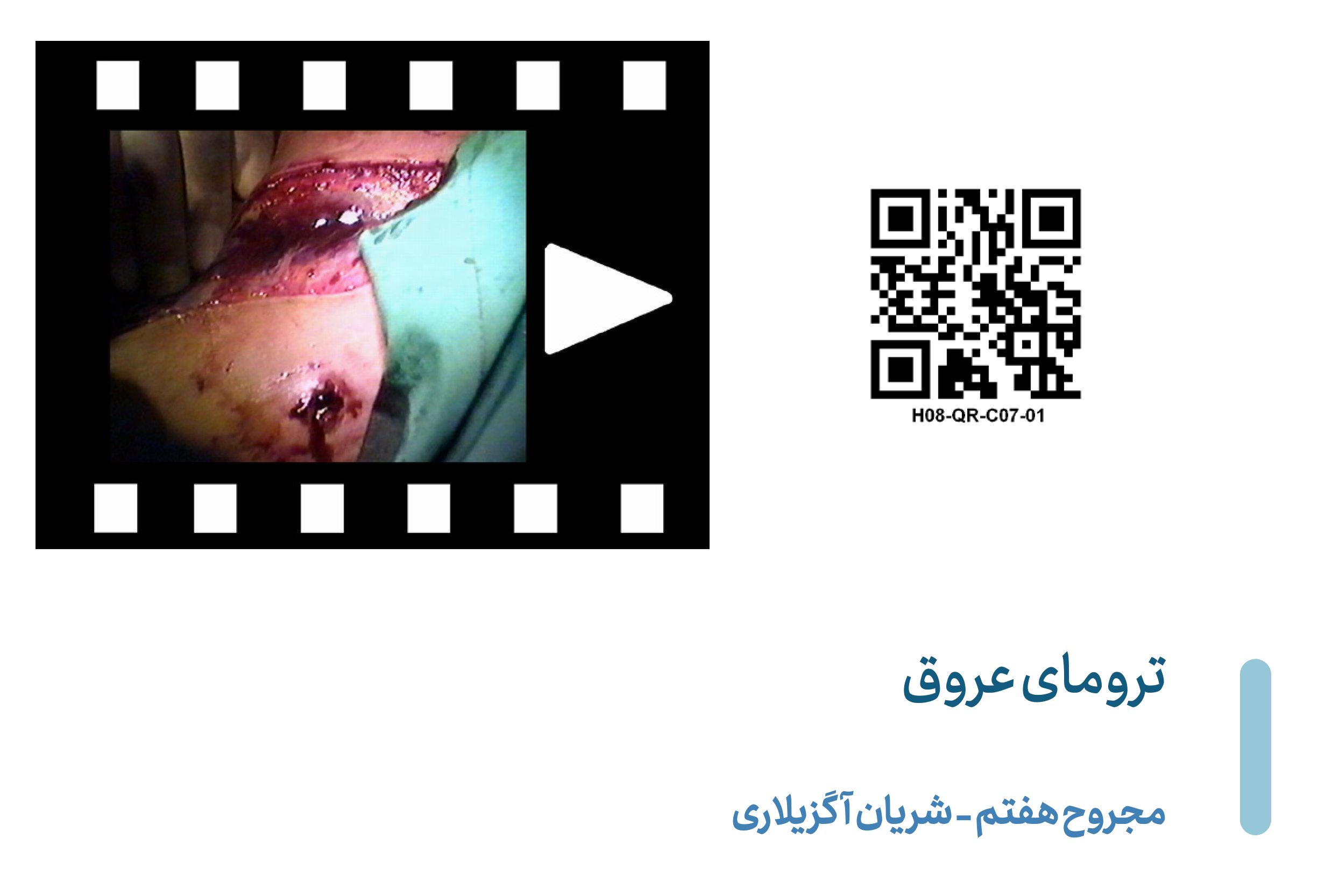 Axillary-V07