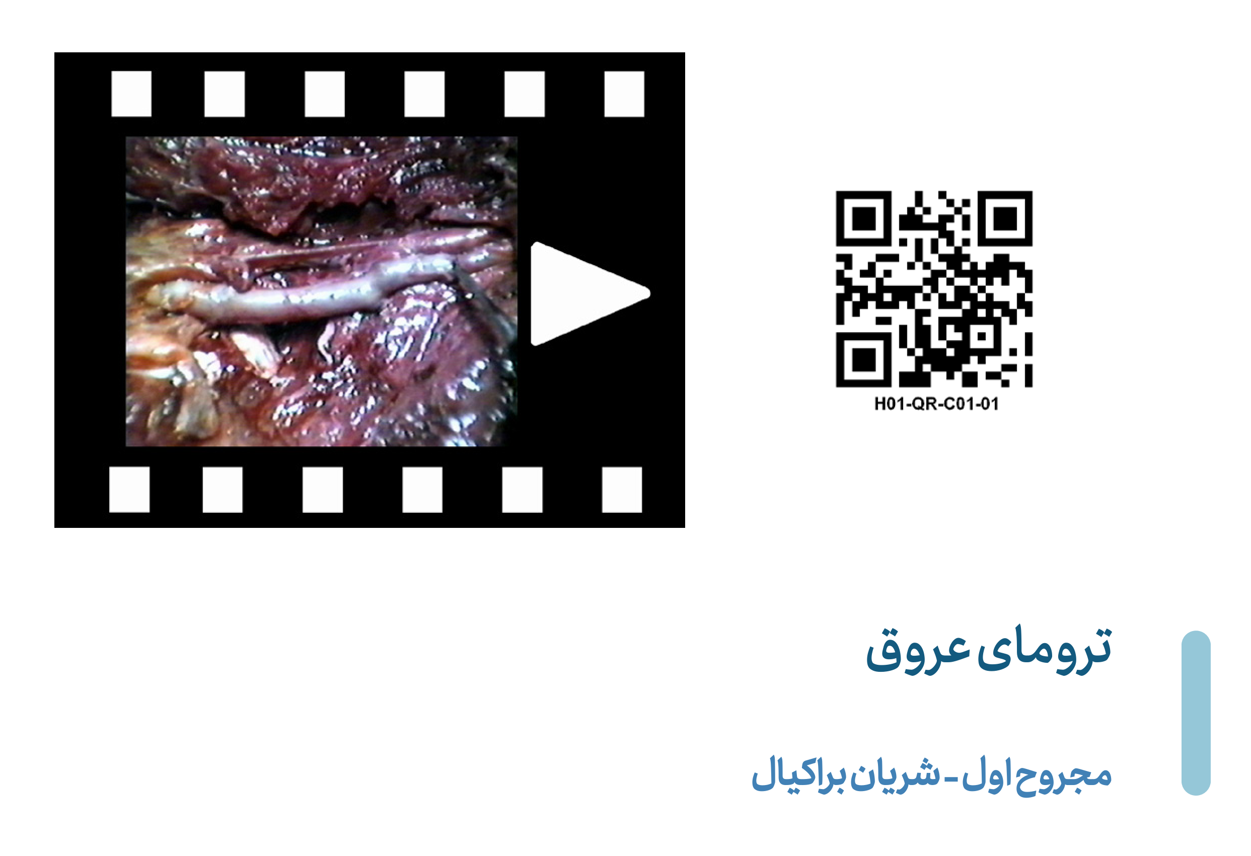 Brachial