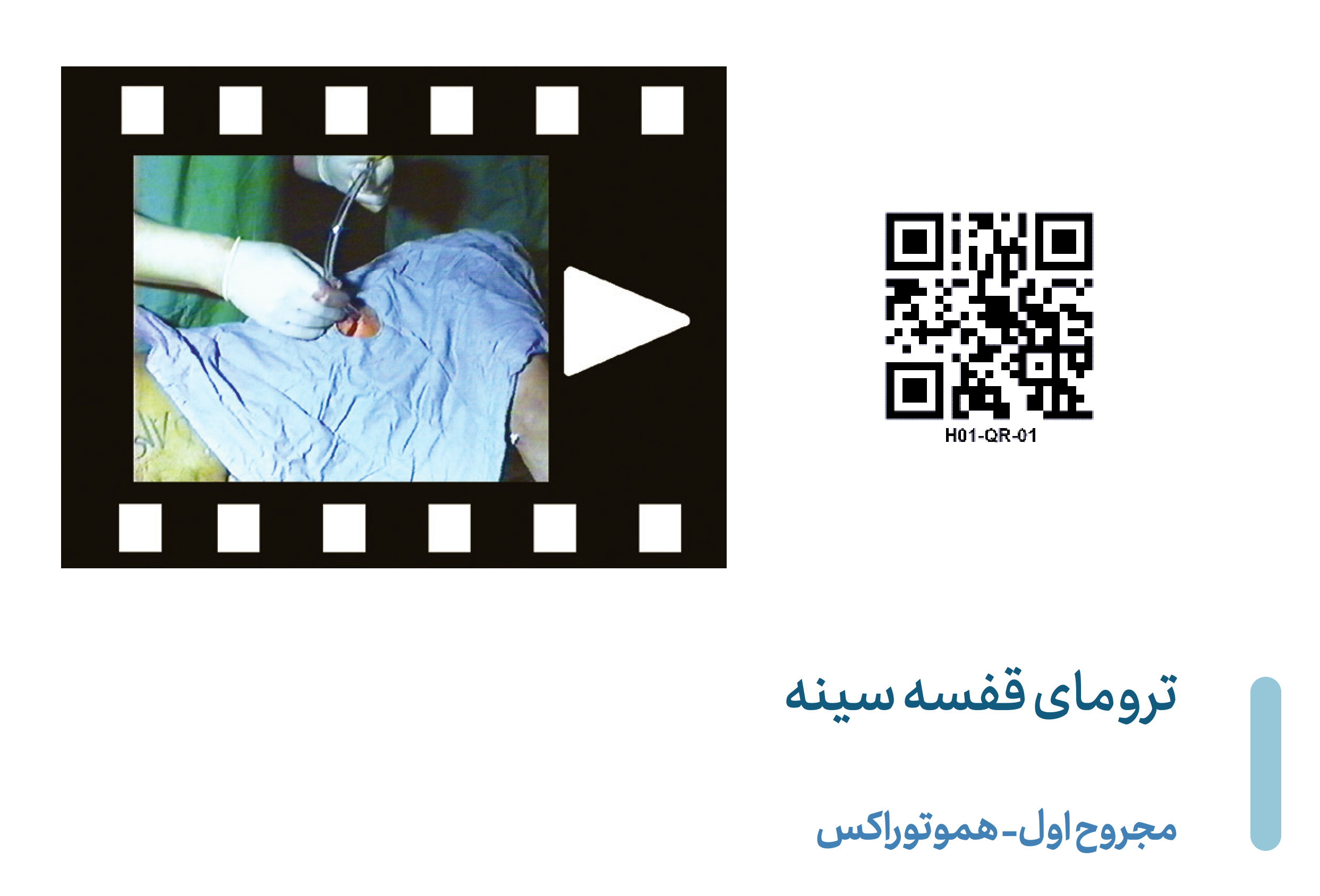Hemothorax