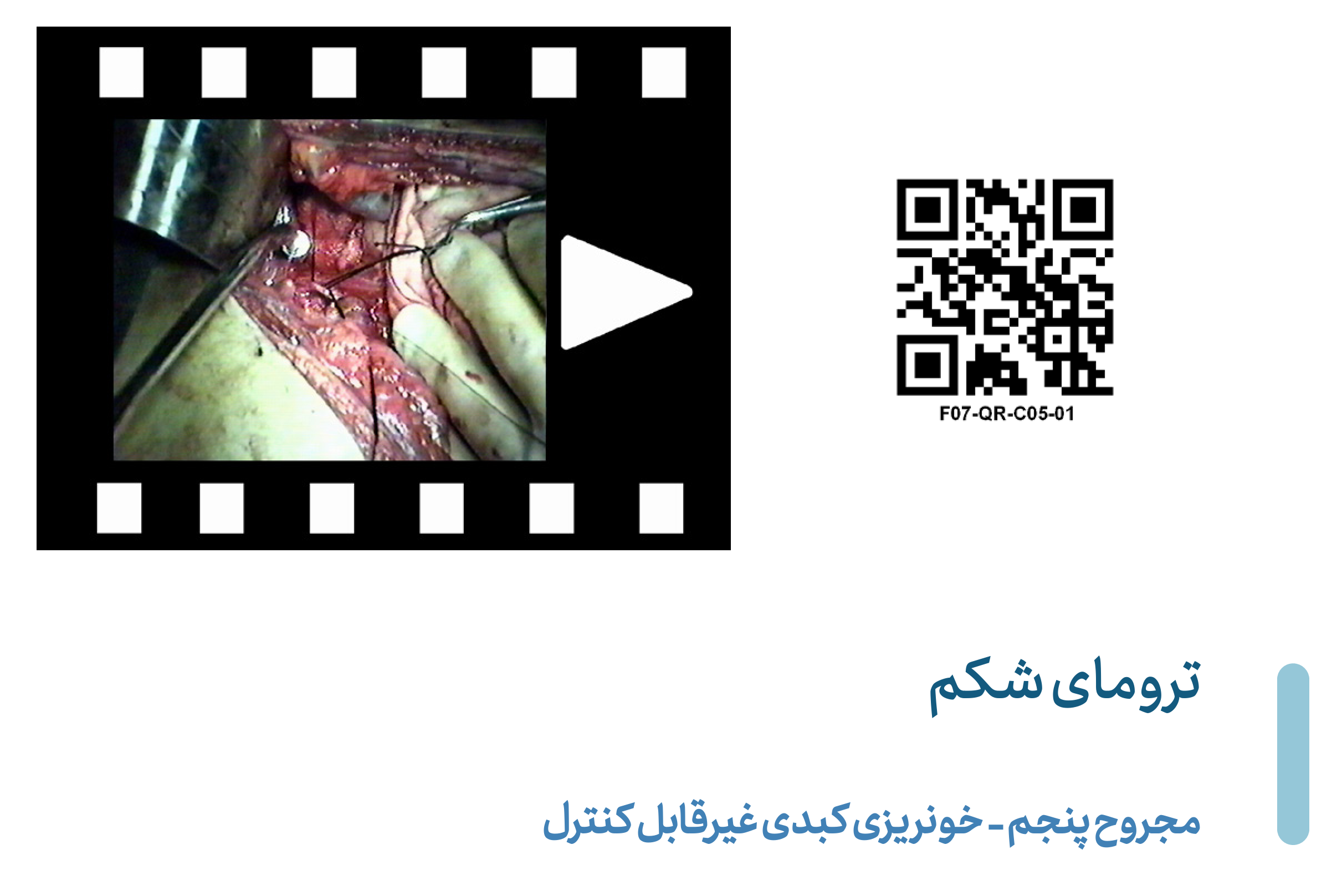 Hepatic-C