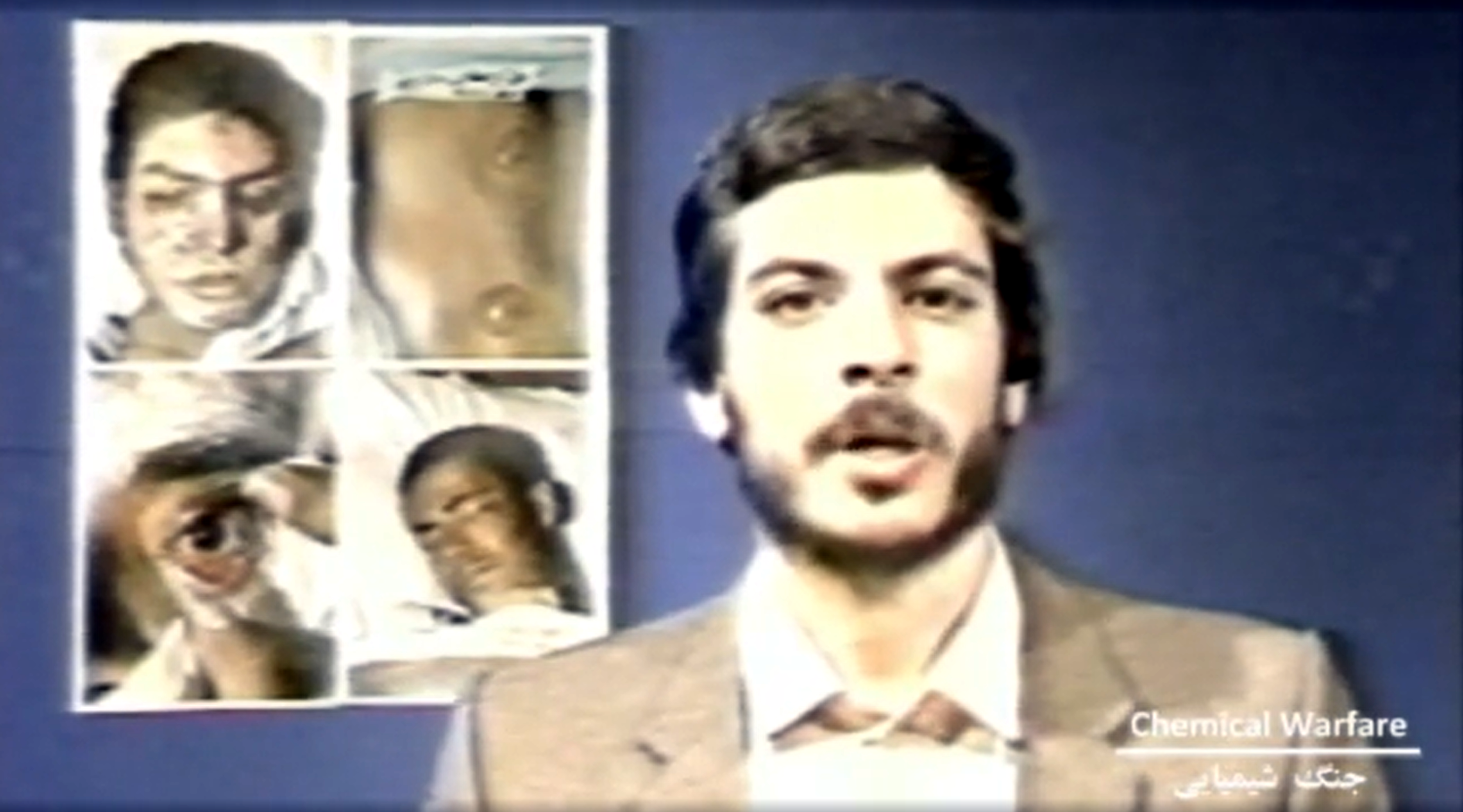 UN Report 1984