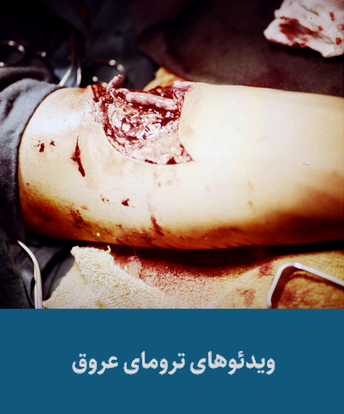 ترومای عروق